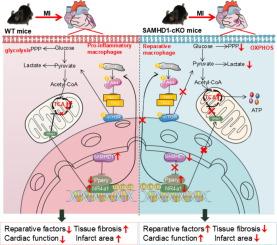 SAMHD1 promotes cardiac repair post myocardial infarction by targeting NR4a1 to regulate macrophage metabolic reprogramming