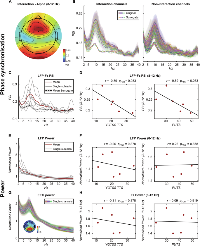 Thalamo-frontal functional connectivity patterns in Tourette Syndrome: Insights from combined intracranial DBS and EEG recordings