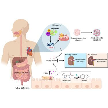 Gut-microbiota-derived indole sulfate promotes heart failure in chronic kidney disease