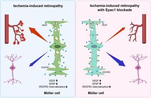 Epac1 deletion attenuates Müller glial pathological activation and mitigates retinal neurodegeneration in ischemia-induced retinopathy