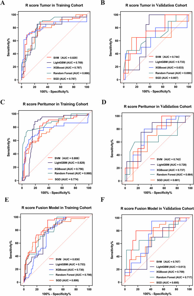 Augmenting conventional criteria: a CT-based deep learning radiomics nomogram for early recurrence risk stratification in hepatocellular carcinoma after liver transplantation.