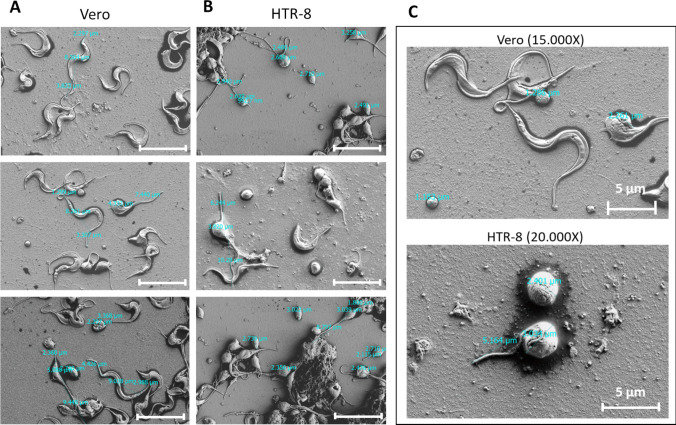 Differential susceptibility of human placental trophoblasts to Trypanosoma cruzi infection.