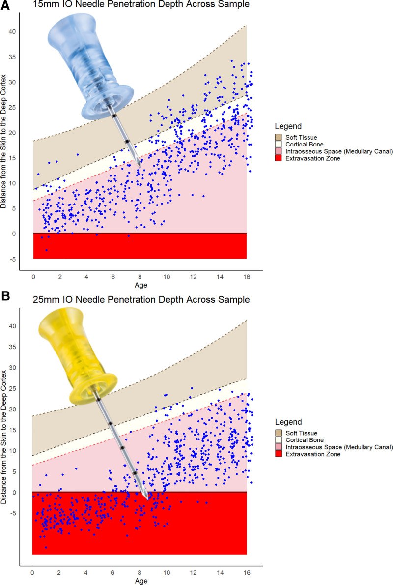 Evaluating the Safety of Current Intraosseous Needles and the Potential for Age-Based Guidance Using a Large-Scale Pediatric CT/MRI Imaging Study.