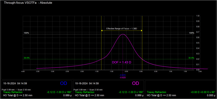Objective Depth-of-Focus Estimation from Wavefront Measurements After Implantation of an Isofocal Intraocular Lens.