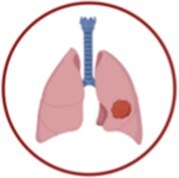 Circulating Tumor DNA detection in cancer: a comprehensive overview of current detection methods and prospects.