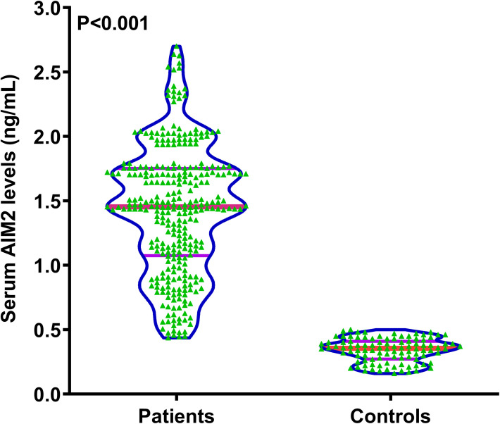 Feasibility of Absent in Melanoma 2 as a Serological Marker in Relation to Complicated Community-Acquired Pneumonia in Children: A Prospective Cohort Study.