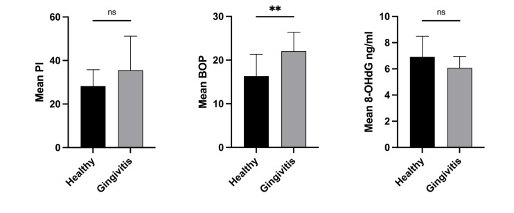 Does Daily Intake of Matcha Tea Enhance The Periodontal Health of Patients With Localised Gingivitis: A Control Study.