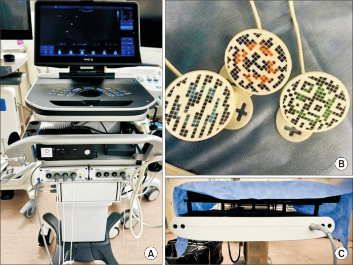 <i>In-vivo</i> evaluation of an augmented reality enhanced ultrasound needle guidance system for minimally invasive procedures in porcine models: a preclinical comparative study.