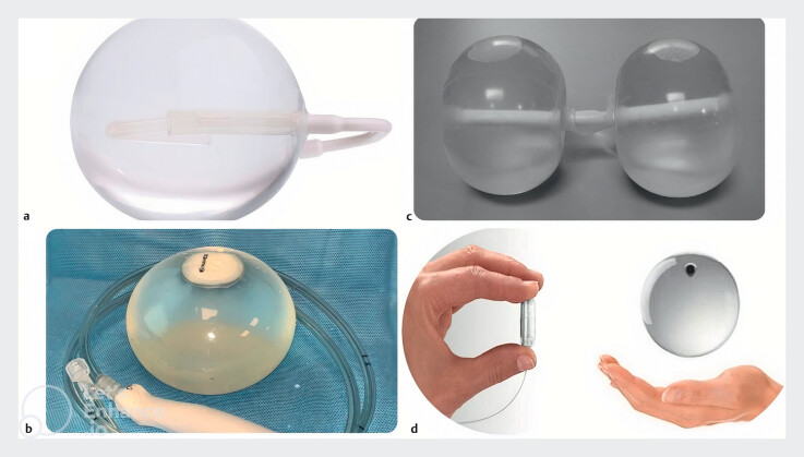Intragastric balloon for obesity treatment: Systematic review and meta-analysis of randomized controlled trials.