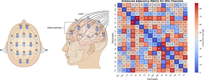 A novel spatiotemporal model with advanced feature extraction and unified brain network for depression detection using electroencephalogram signals.