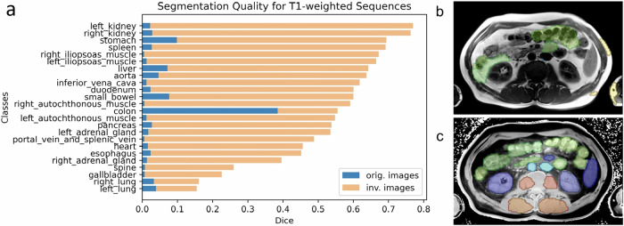 MRI annotation using an inversion-based preprocessing for CT model adaptation.