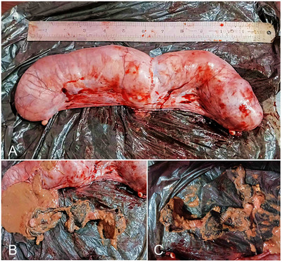 Surgical Management of Foetal Maceration in a Domestic Shorthair Queen.