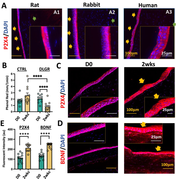 P2X4 Receptor Antagonist Ameliorates Ocular Pain in Rats After Lacrimal Gland Removal.