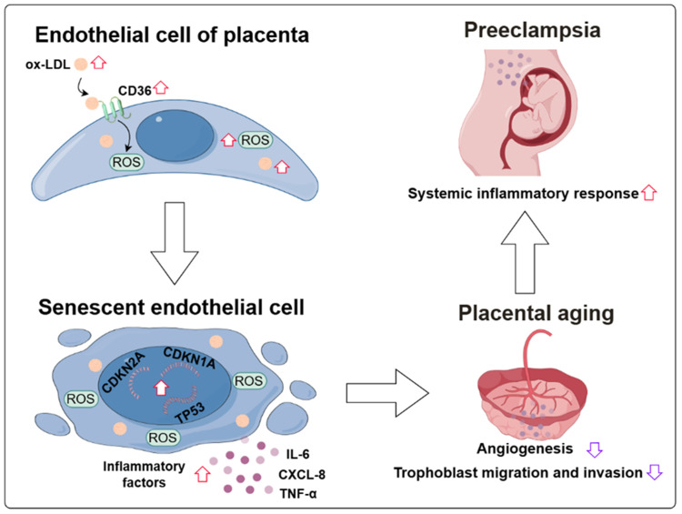 Fatty Acid Transporter CD36 Promotes Ox-LDL-Induced Senescence of Vascular Endothelial Cells in Preeclampsia.