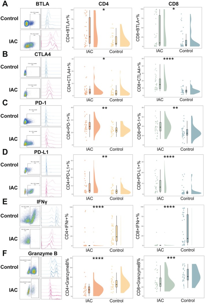 T Cell Exhaustion and Function State Correlated With Outcomes in Patients With Intra-Abdominal Candidiasis.
