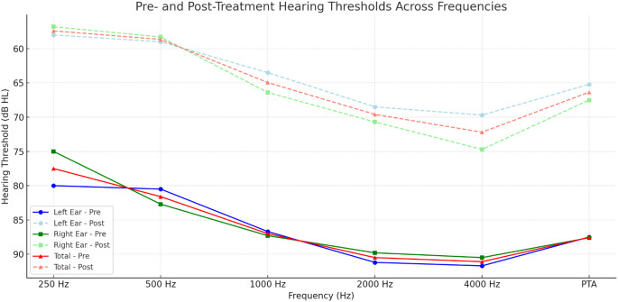 Evaluation of autoimmune and inflammatory markers in bilateral sudden hearing loss.