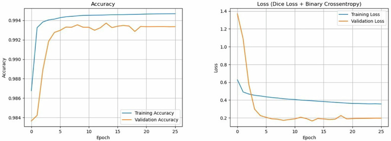 Deep learning for automated segmentation of central cartilage tumors on MRI.