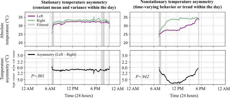 Exploring the Value of Continuous Plantar Temperature Monitoring for Diabetic Foot Health Management: Observational, Prospective Cohort Study.