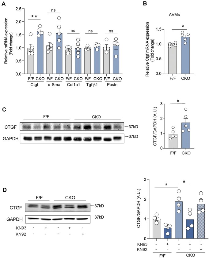 Cardiac β2 adrenergic receptor deletion drives calmodulin kinase II upregulation to induce connective tissue growth factor in cardiac fibrosis and diastolic dysfunction.