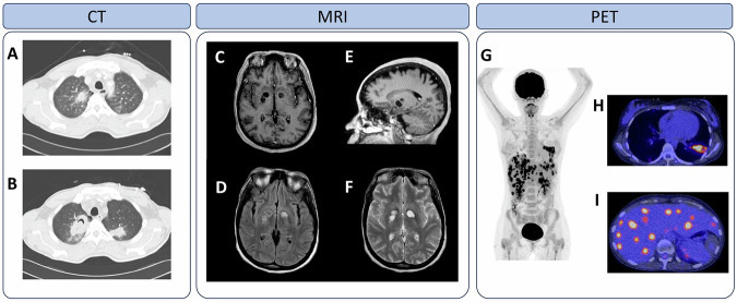 Fungal infections in focus: accelerating non-invasive imaging from preclinical insights to clinical breakthroughs.
