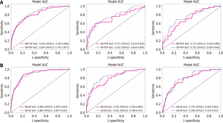 Multiparametric magnetic resonance imaging of deep learning-based super-resolution reconstruction for predicting histopathologic grade in hepatocellular carcinoma.