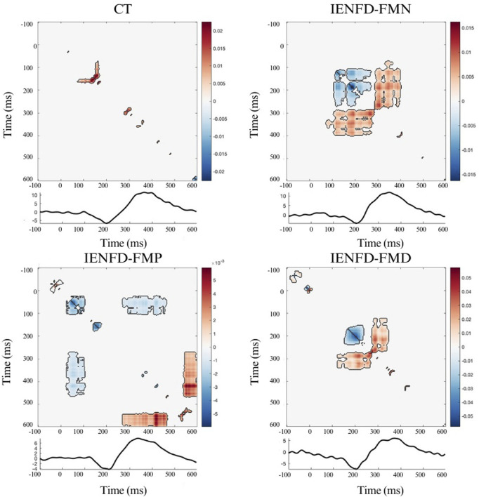 Temporal interaction information and laser evoked responses: preliminary results in fibromyalgia patients with small fibers pathology.