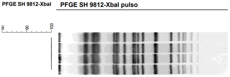 [Recurrent chorioamnionitis due to <i>Citrobacter koseri</i>: case report and literature review].