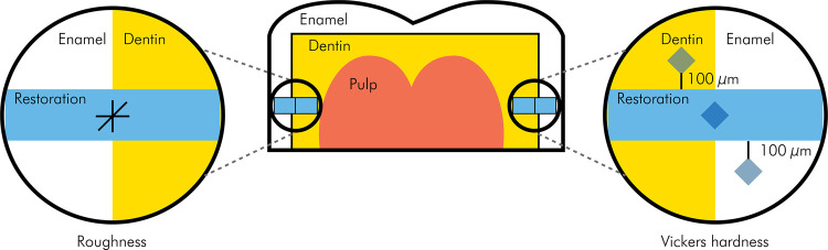 Surface properties of direct restorations and adjacent dental tissues after saliva exposure.