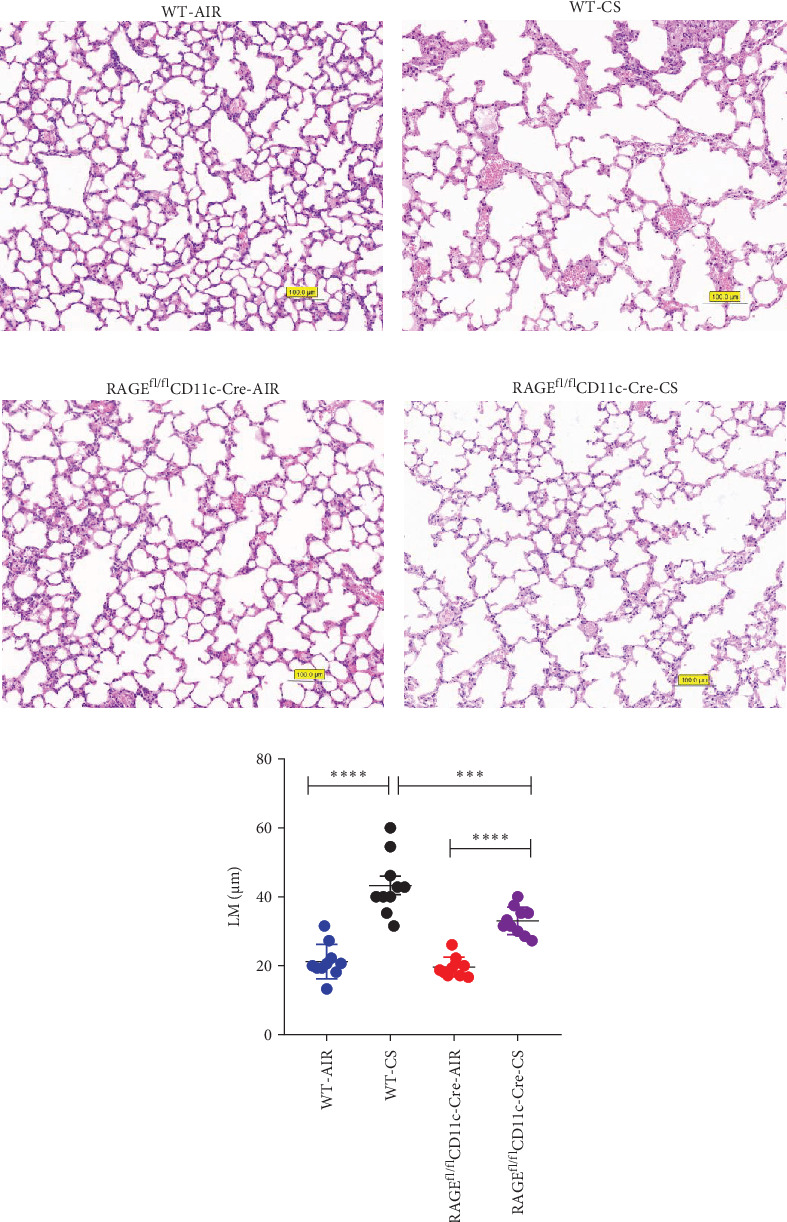 Activation of Myeloid Dendritic Cells by Up-Regulating RAGE/JAK/STAT Pathway Induced by Cigarette Smoke Exposure in Mice With Emphysema.