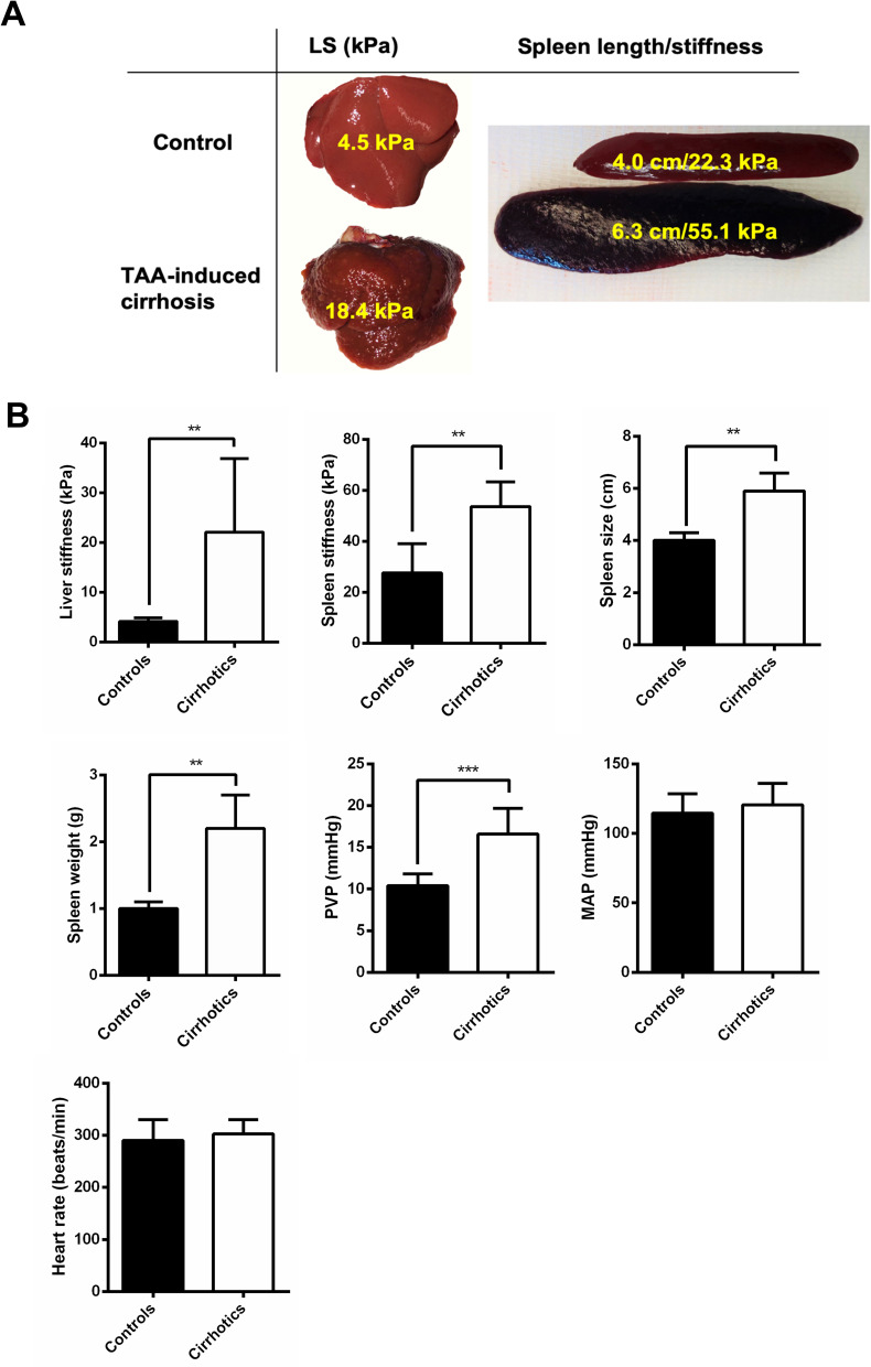 Pharmacological Modulation of Liver and Spleen Stiffness in a Cirrhotic Rat Model.