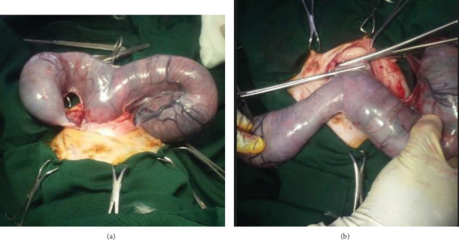 En Bloc Ovariohysterectomy for the Management of Feline Dystocia Due to Partial Primary Uterine Inertia: A Case Report.