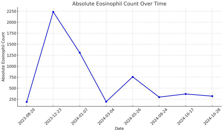 Eosinophilia Induced by Biosimilar Adalimumab (CinnoRA) in a Patient with Psoriasis and Psoriatic Arthritis: A Case Report.
