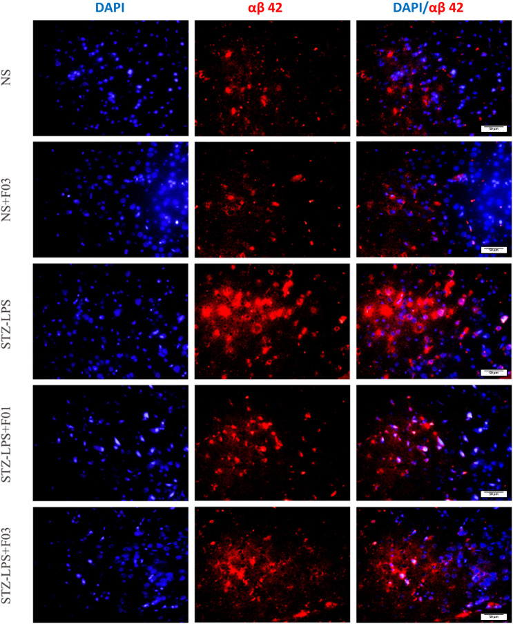 Supplementation with fish oil reduces αβ 42 burden and shifts αβ precursor protein processing toward non-amyloidogenic pathways in a rat model of hyperglycaemic Alzheimer's disease.