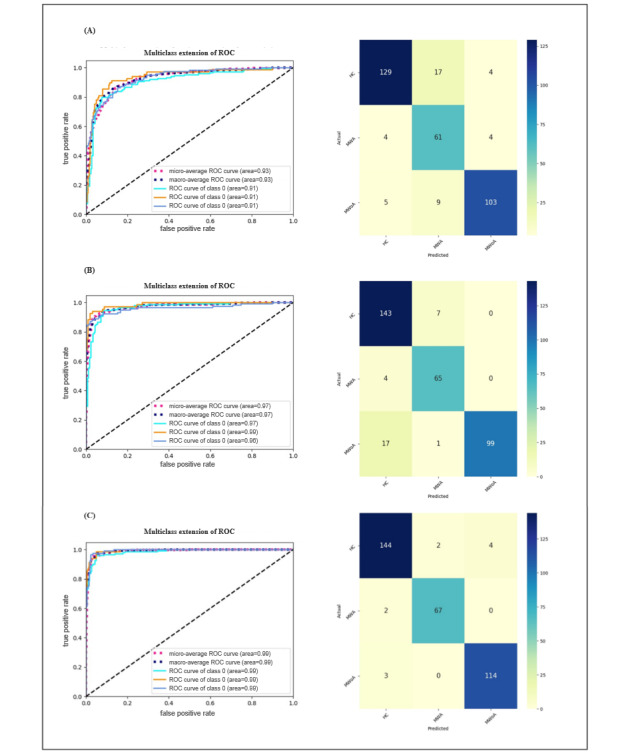 Interpretable Artificial Intelligence Analysis of Functional Magnetic Resonance Imaging for Migraine Classification: Quantitative Study.