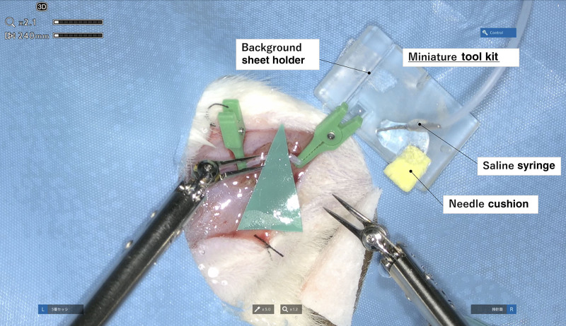 The First Microsurgery-assisting Robot Equipped With an Automatic Instrument Exchange System and a Miniature Tool Kit.