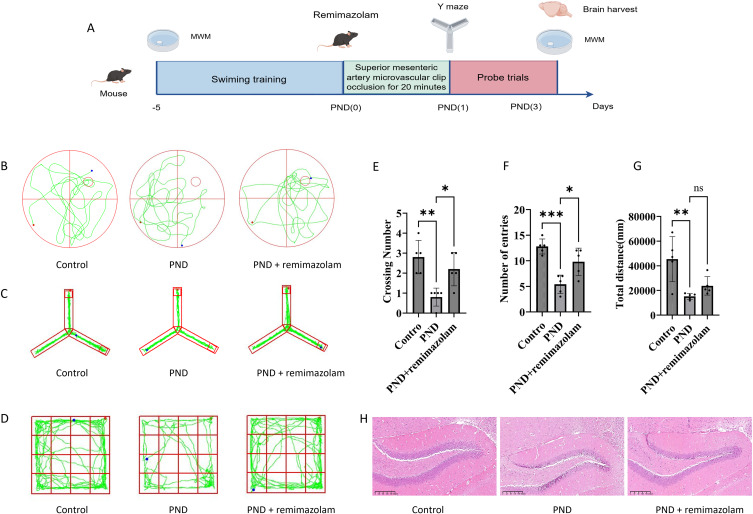 Exploration of Key Genes and Molecular Mechanisms in Mice with Perioperative Neurocognitive Disorders Treated with Remimazolam Based on Transcriptomics and Experimental Verification.
