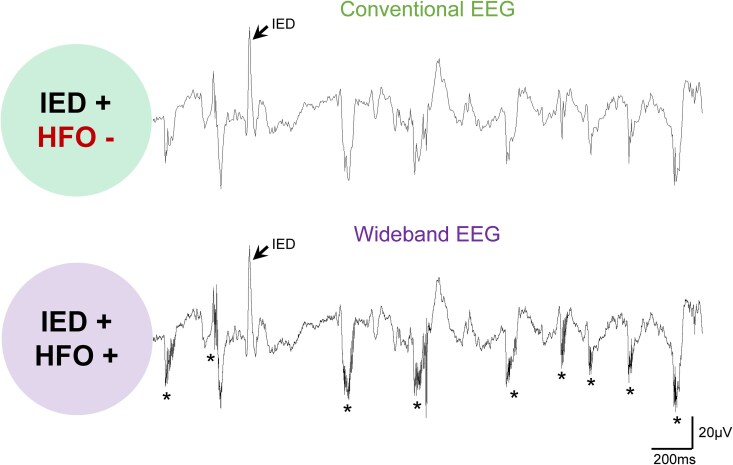 High frequency opportunities for Alzheimer's disease.