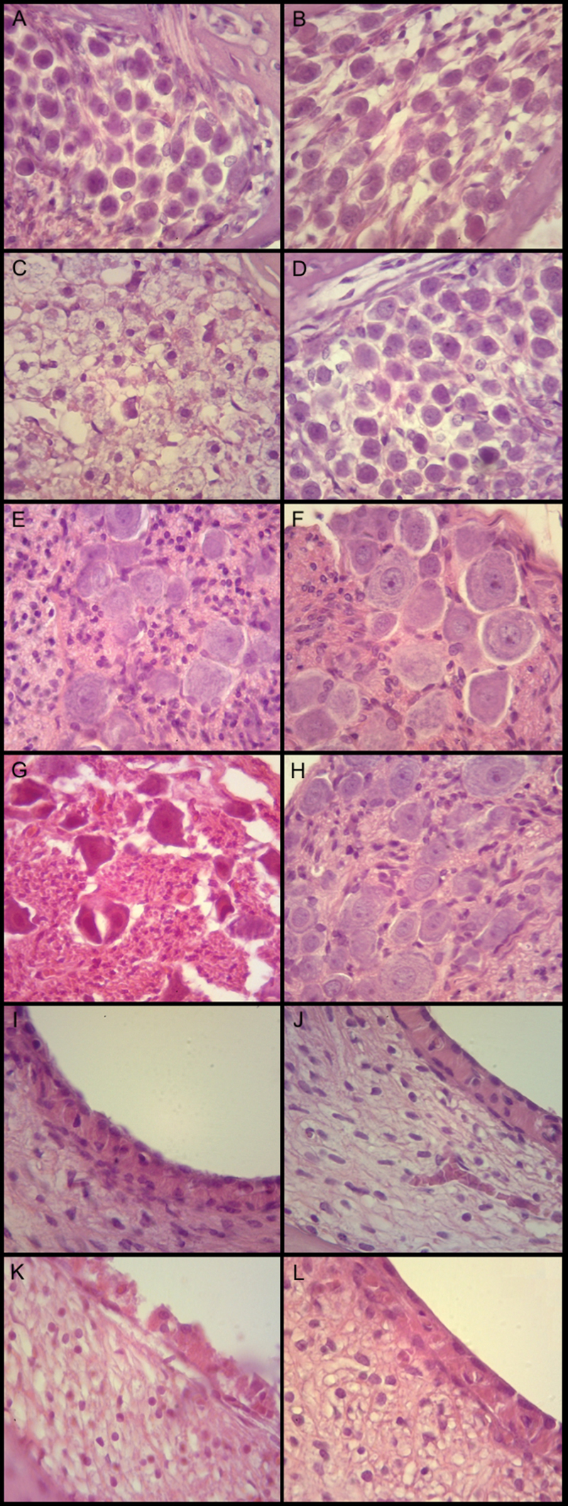 Melatonin Prevents Cisplatin-Induced Cyto-Histopathological Damage in the Bone Marrow and Inner Ear.