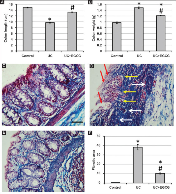 The therapeutic benefits of epigallocatechin gallate in rats with experimentally induced ulcerative colitis are achieved by influencing inflammation and apoptosis.
