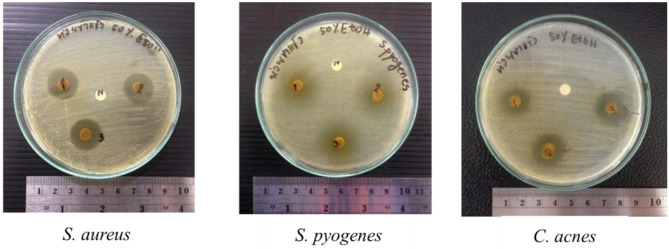 TLC-bioautography-guided valorization of vetiver (Chrysopogon spp.) leaf extracts into an anti-acne gel.
