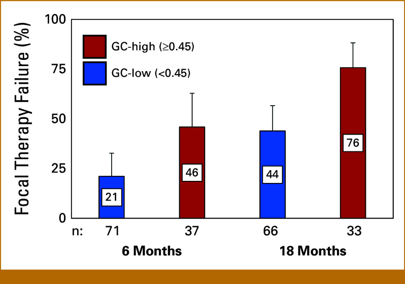 Genomic Biomarker for Prostate Cancer Focal Therapy: Post Hoc Assessment of a Phase II Clinical Trial.