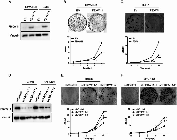 FBXW11 inhibits tumorigenesis by ubiquitinating YB1 in hepatocarcinoma.