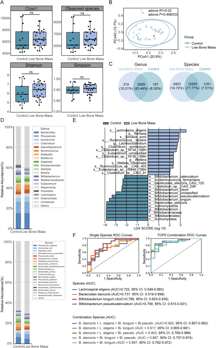 Gut microbiota-metabolome remodeling associated with low bone mass: an integrated multi-omics study in fracture patients.