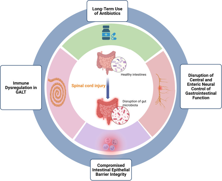 Gut-Spinal Cord Axis in Spinal Cord Injury: Bidirectional Inflammatory Mechanisms and Microbiota-Targeted Therapeutic Strategies.