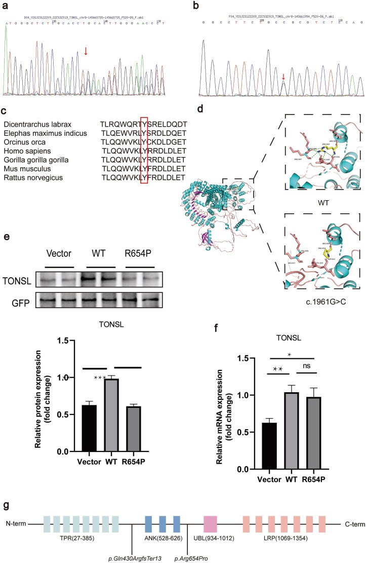 A case report of SPONASTRIME dysplasia with novel TONSL mutation: genetic analysis, clinical manifestations, and the effect of growth hormone treatment.