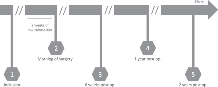 Influence of Bariatric Surgery on Endothelial and Glycocalyx Biomarkers in Obesity and Type 2 Diabetes.