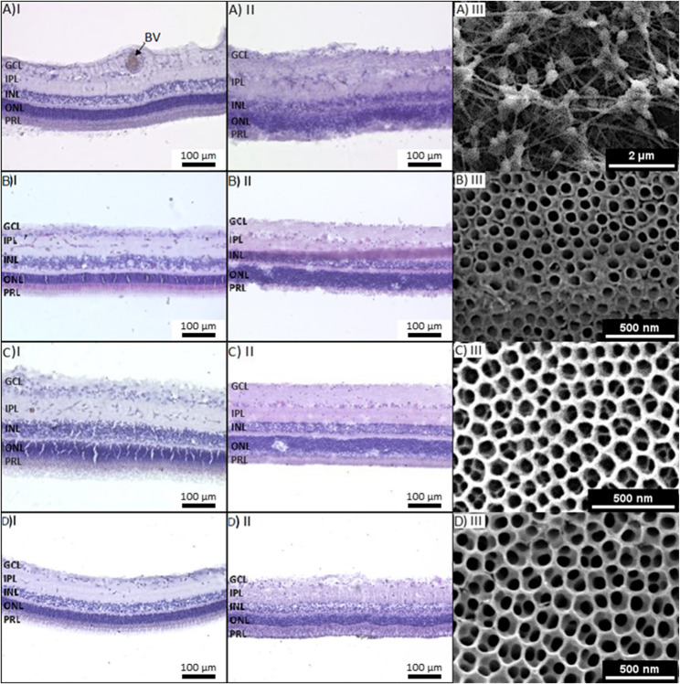 Organotypic Culture of Adult Vascularized Porcine Retina Explants In Vitro on Nanotube Scaffolds.