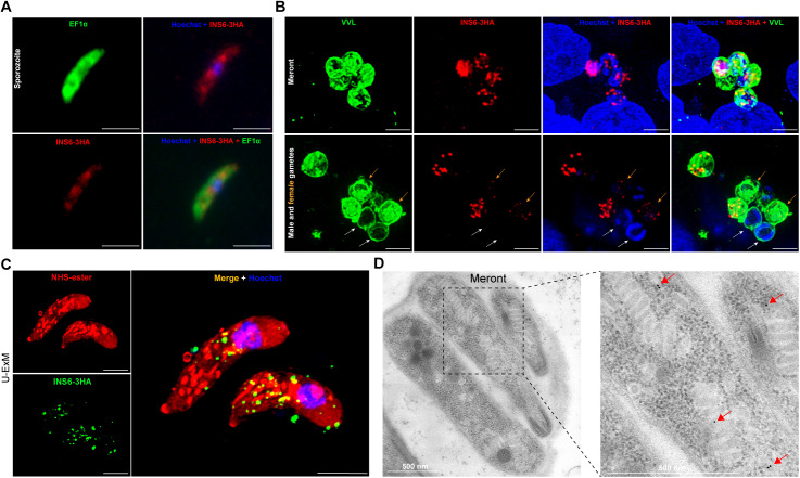 Cryptosporidium parvum protease INS6 plays an important role in parasite proliferation and pathogenicity.