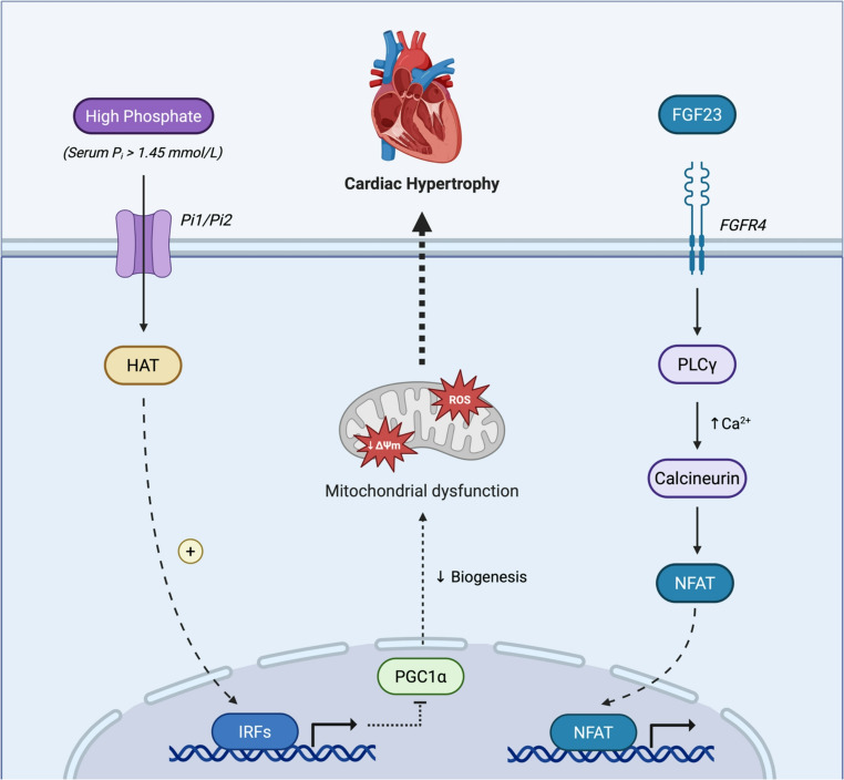 Recharging the Powerhouse: Mitochondrial Dysfunction and Therapy in Cardiorenal Syndrome Type 4.