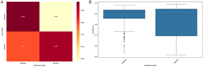 Code-Free Machine Learning for the Detection of Common Ophthalmic Diseases.